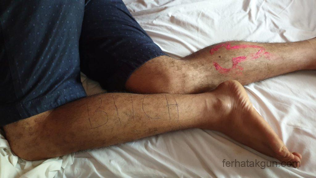 Pedasi - Colors of Light - Joel liegt im Alkohol-Koma